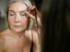 Deep plane facelift: de nieuwste techniek voor een natuurlijk resultaat