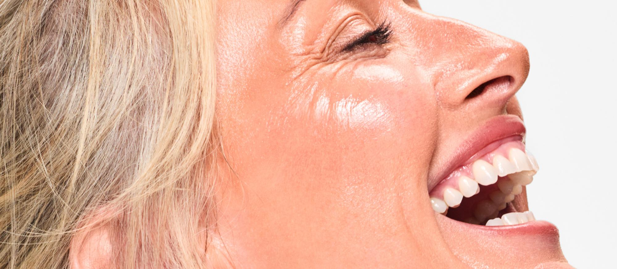 Saggy and Skin Elasticity | Laser Clinics United Kingdom
