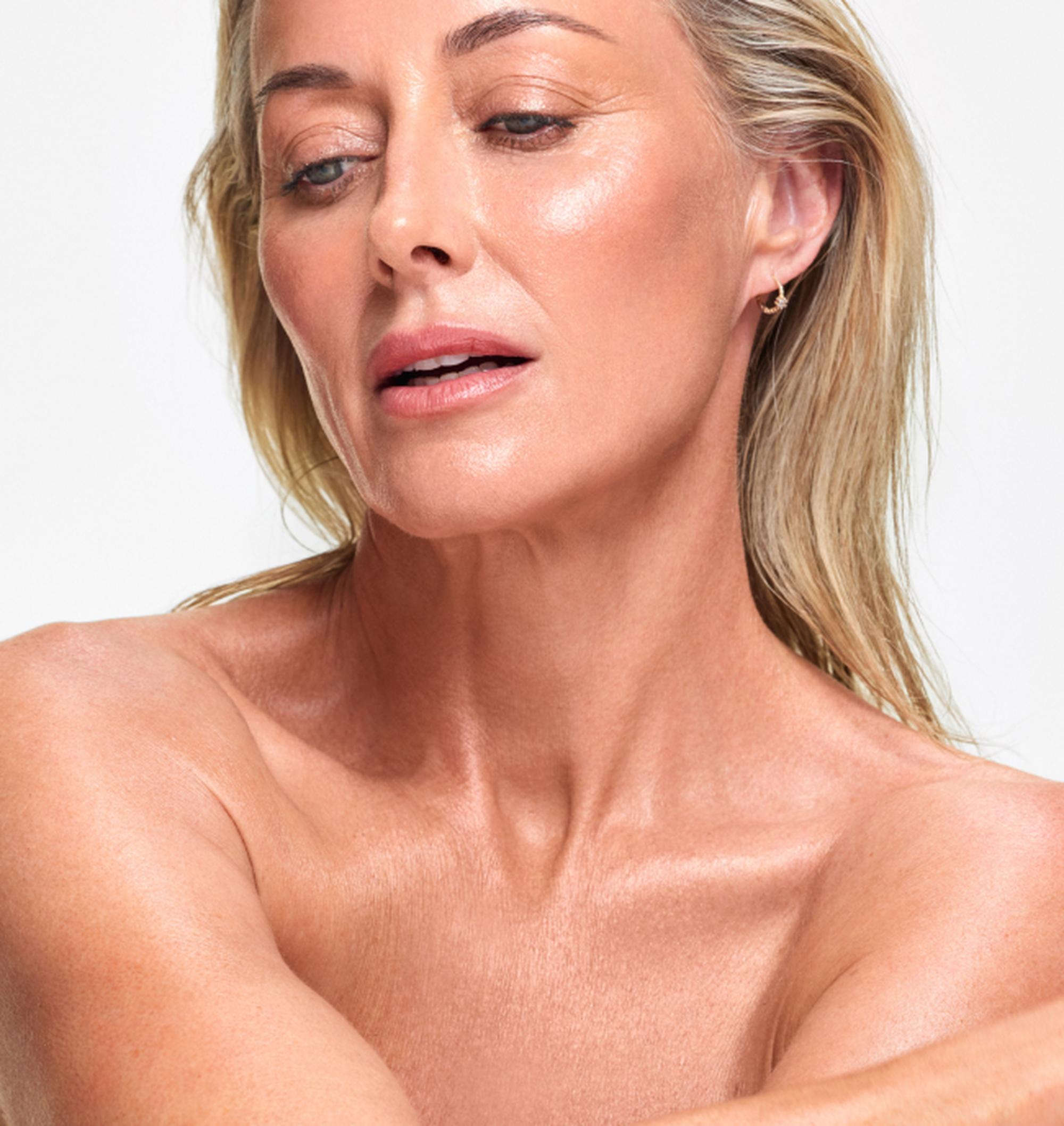 Laser Treatment for Flushing - Face