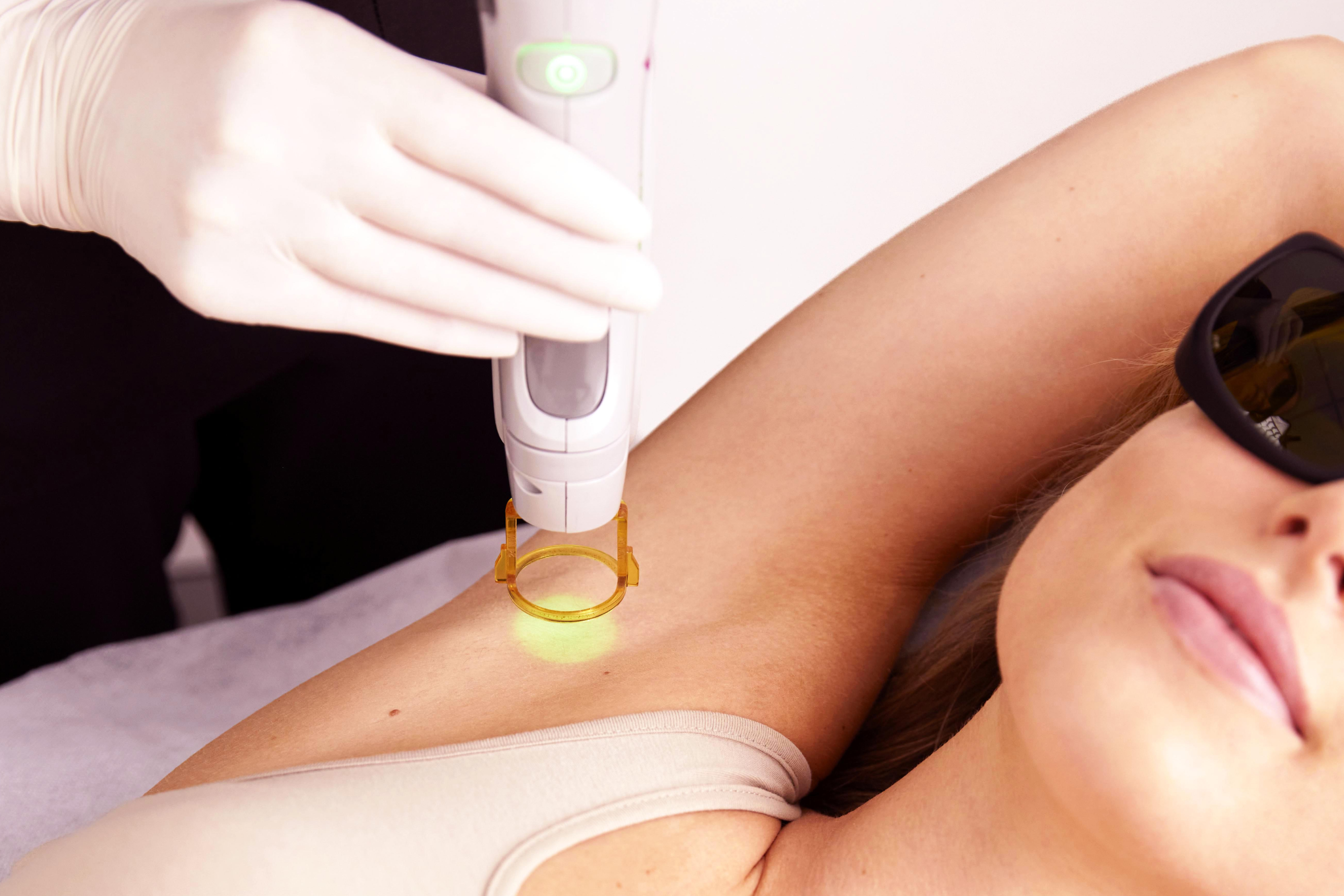Laser Hair Removal Female Hollywood Brazilian & Underarms | Laser Clinics  Australia