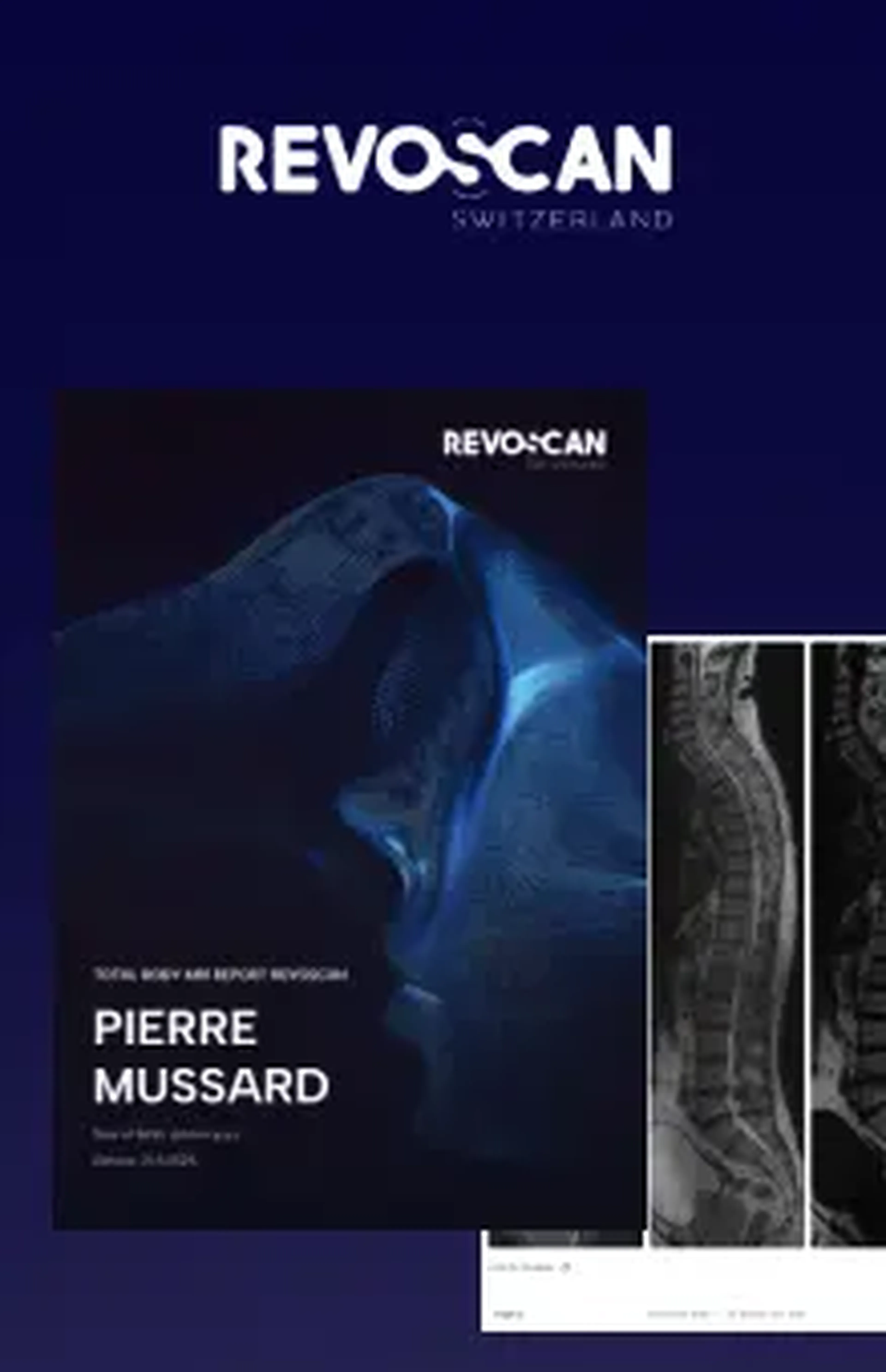 screens of the REVOSCAN MRI report in PDF format