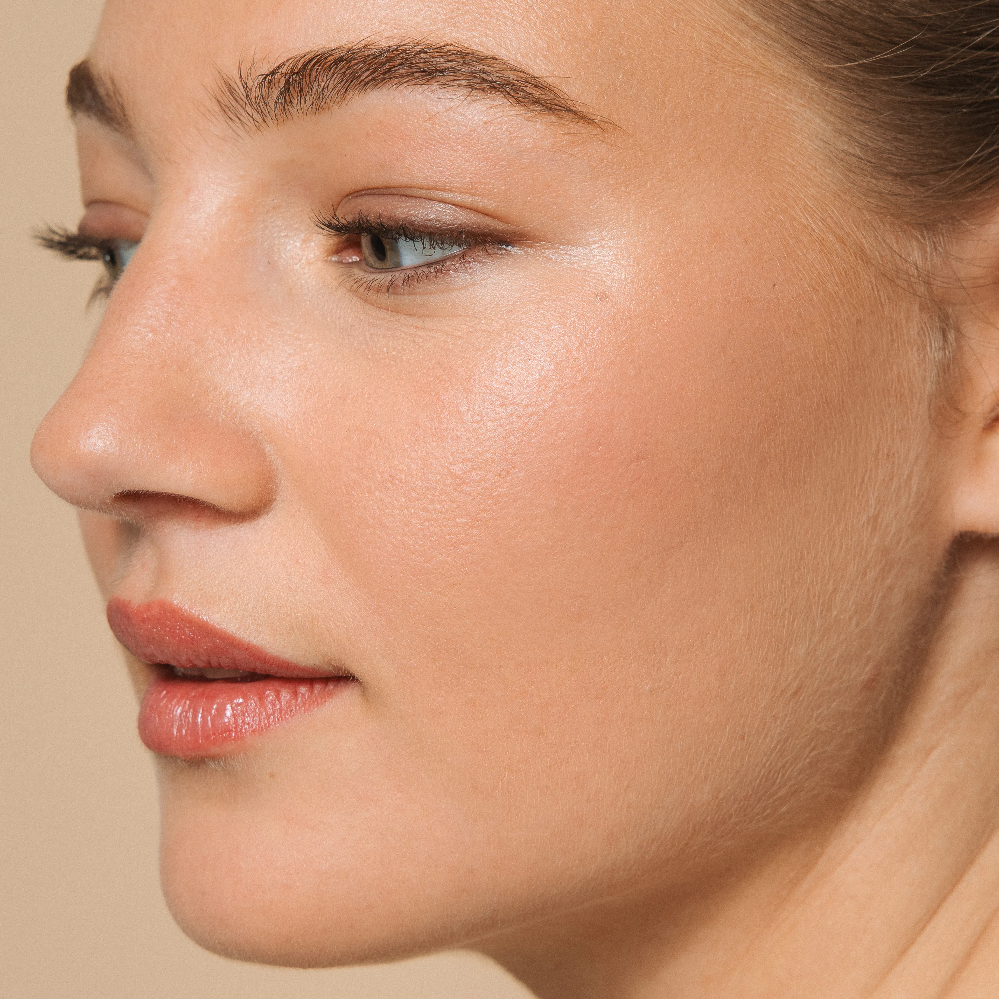 skin-couperose