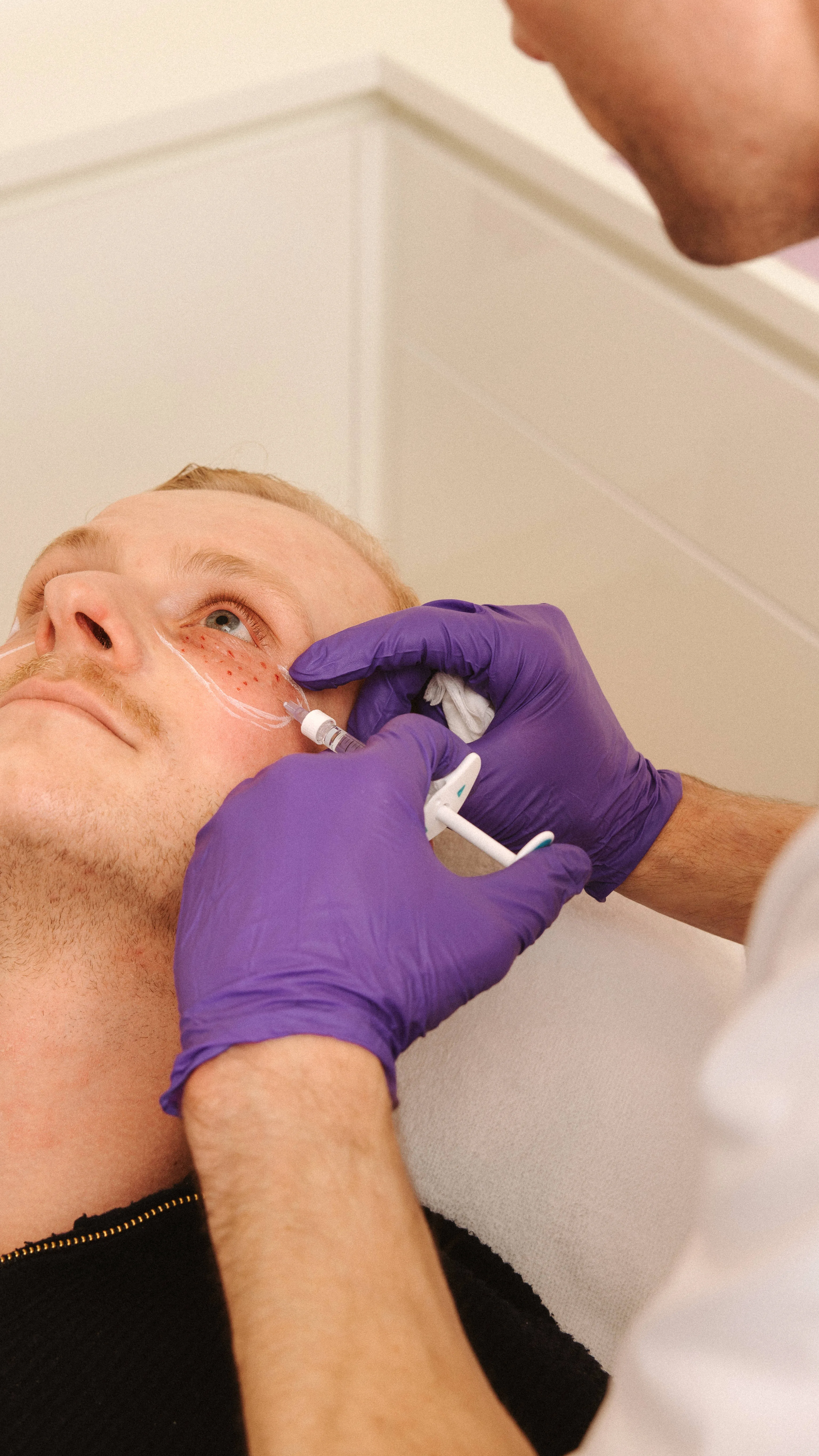 Arts van Soap behandelt de wenkbrauw van een cliënt