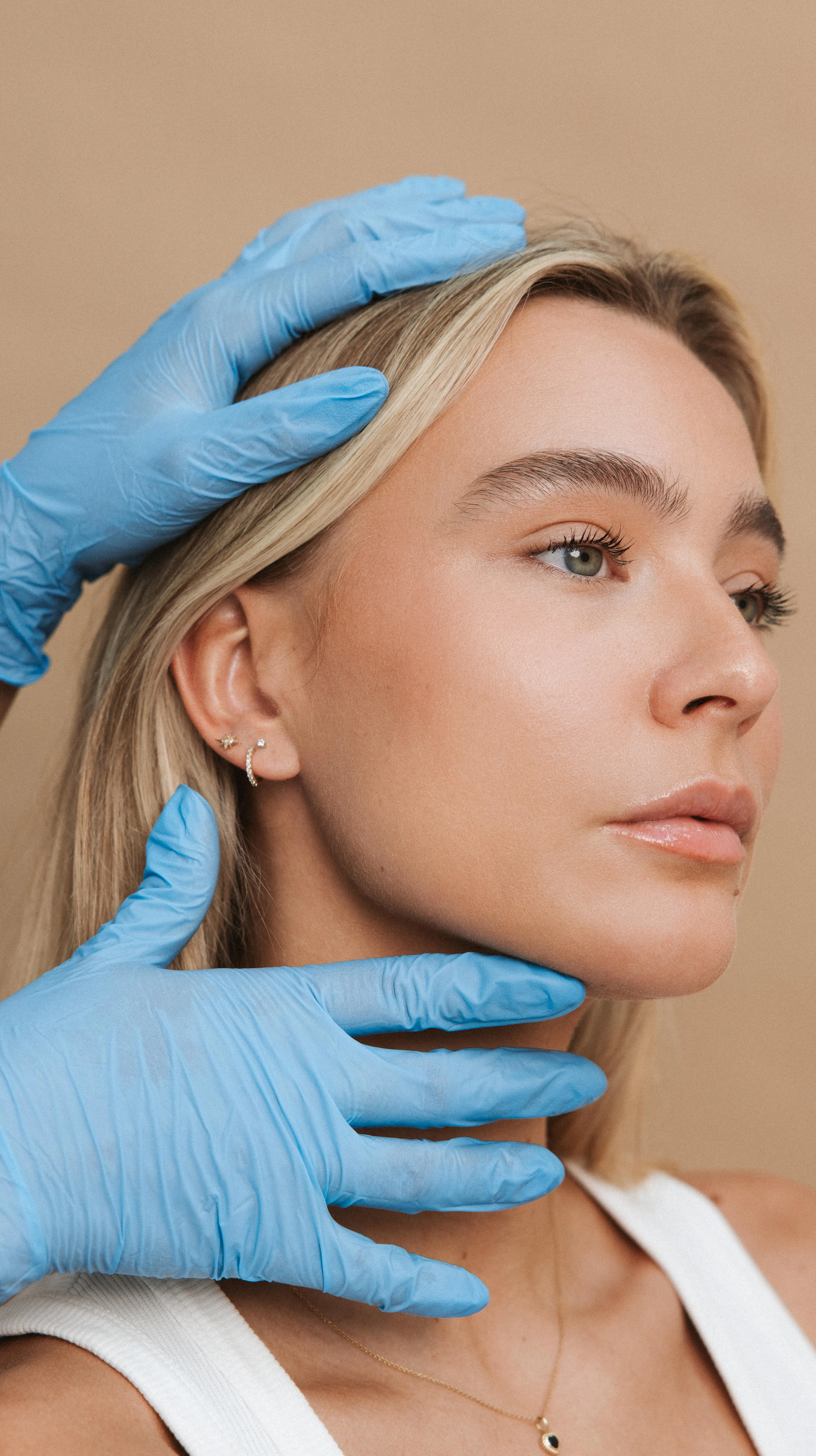 Filler behandeling volgens de No Trace Face techniek bij Soap