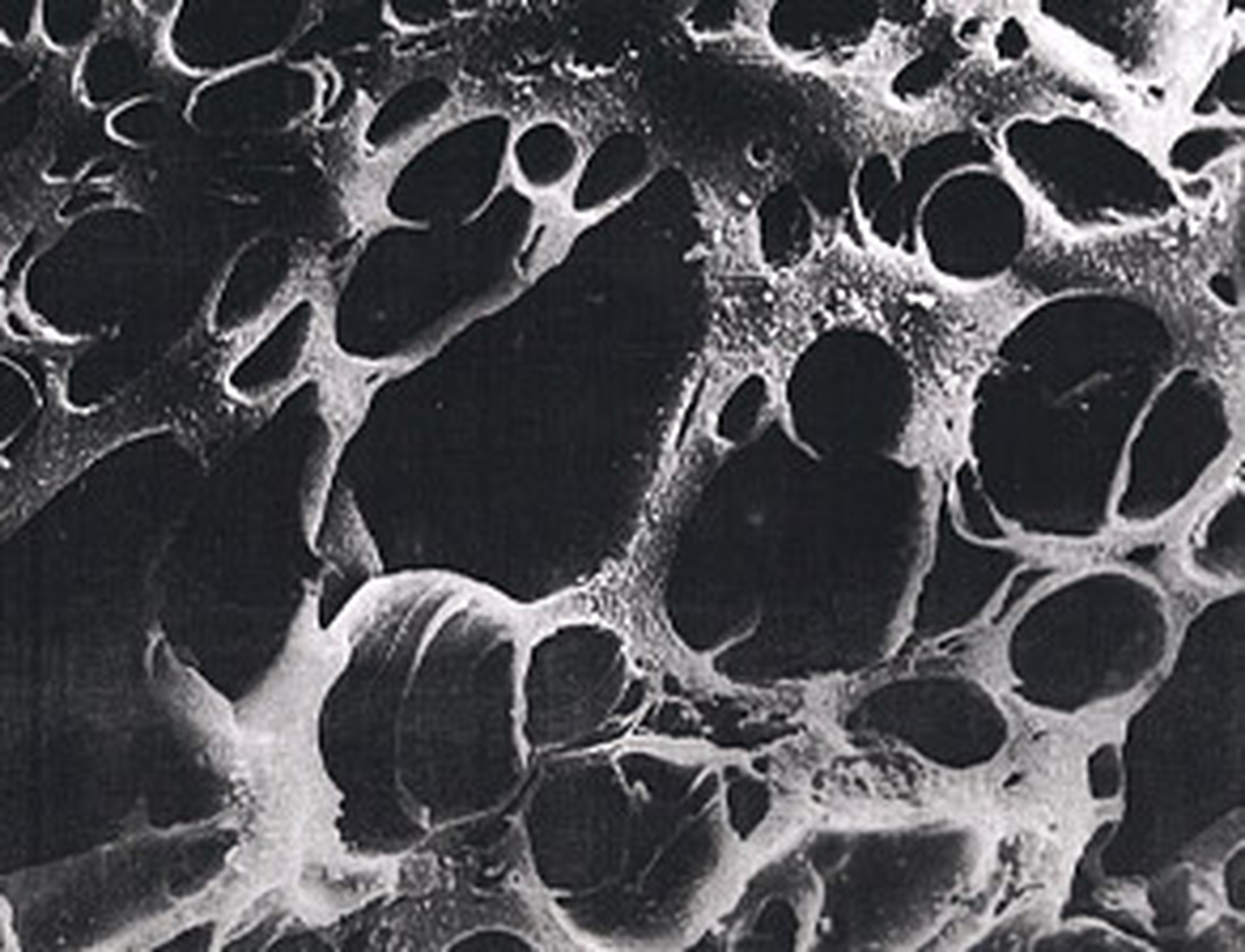 Carbon Pore Structure