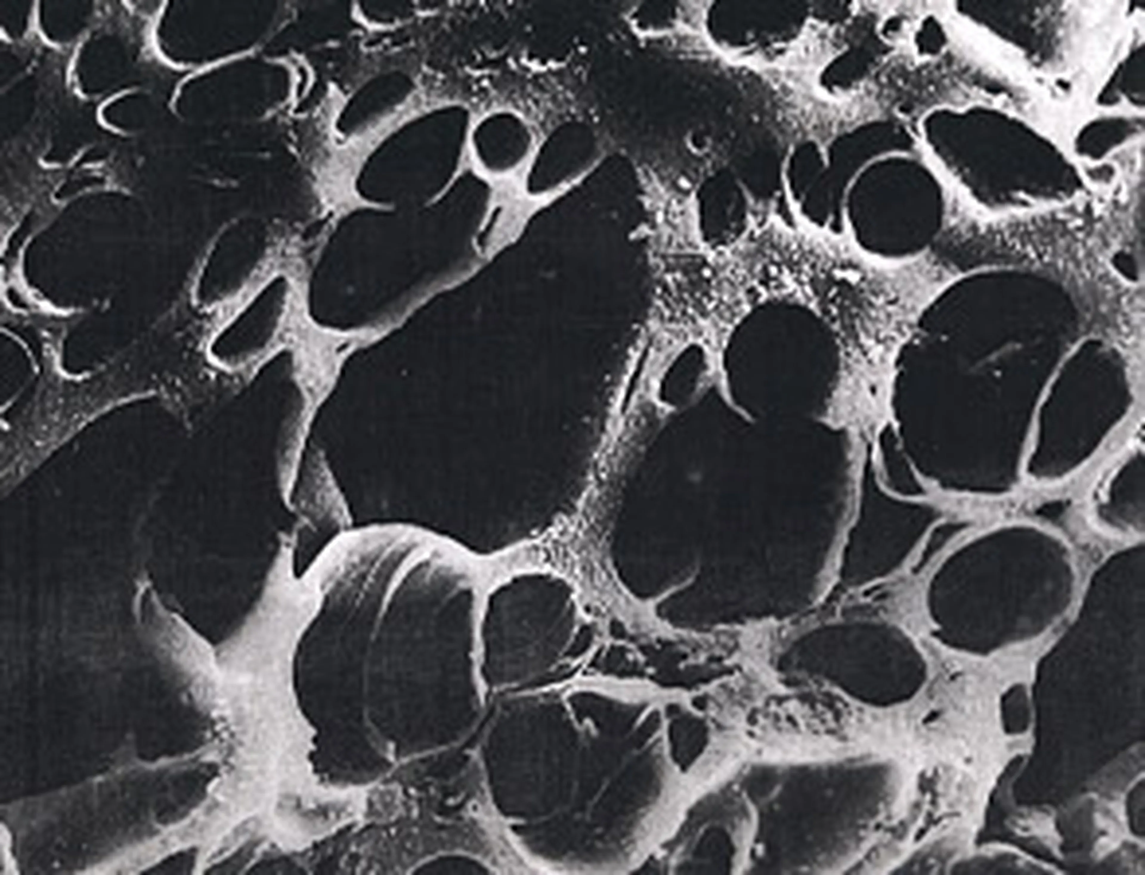 Carbon Pore Structure