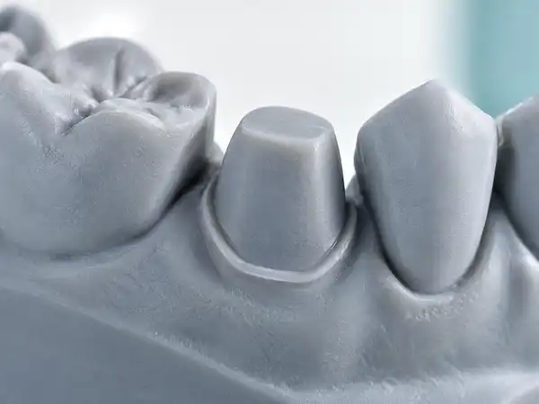 Close-up of a gray dental model showing three molded teeth with realistic textures, highlighting a central tooth prepared for a crown.