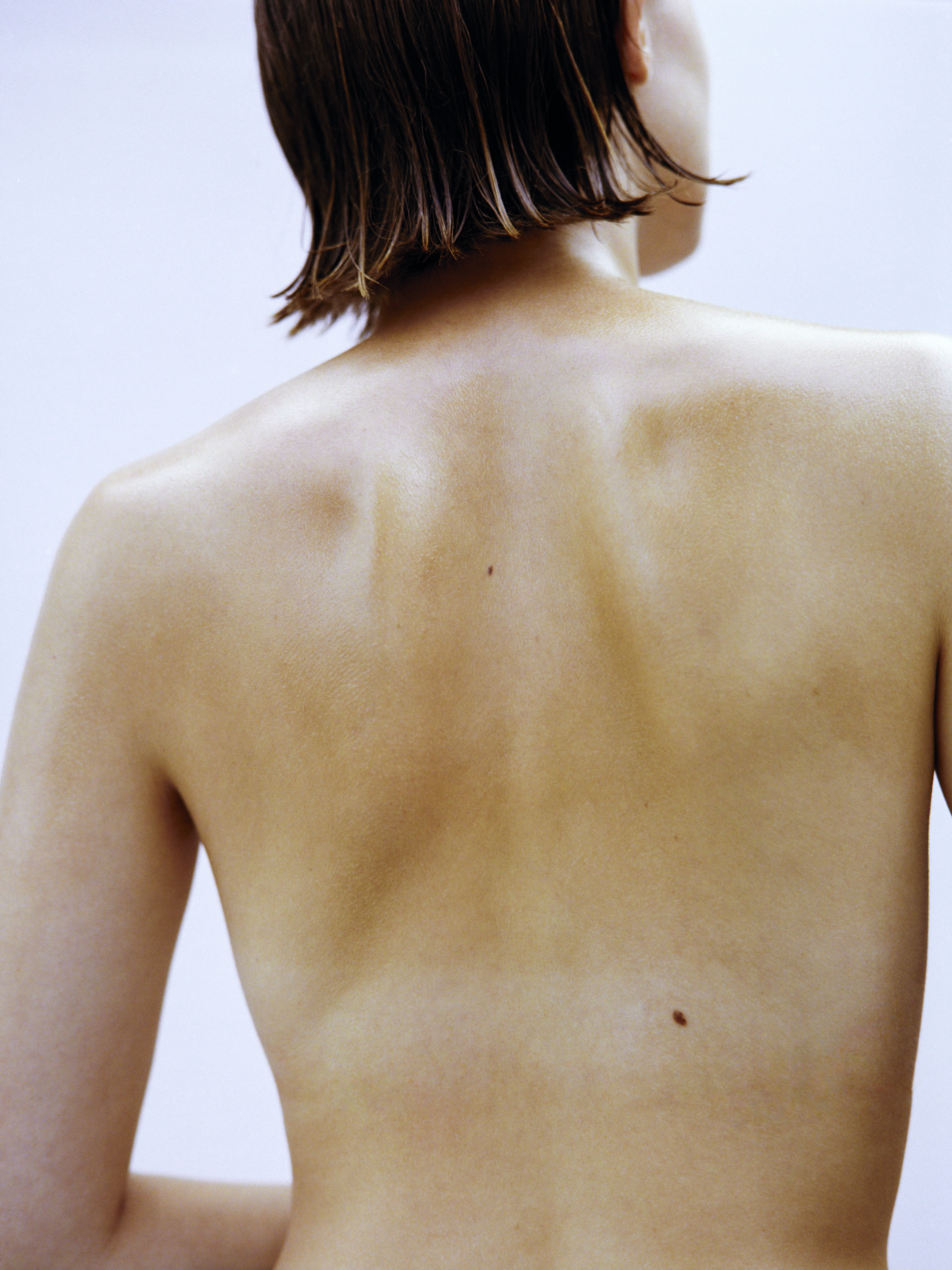 Sunlit bare skin intertwined in an intimate embrace, evoking warmth, sensuality, and natural human connection.