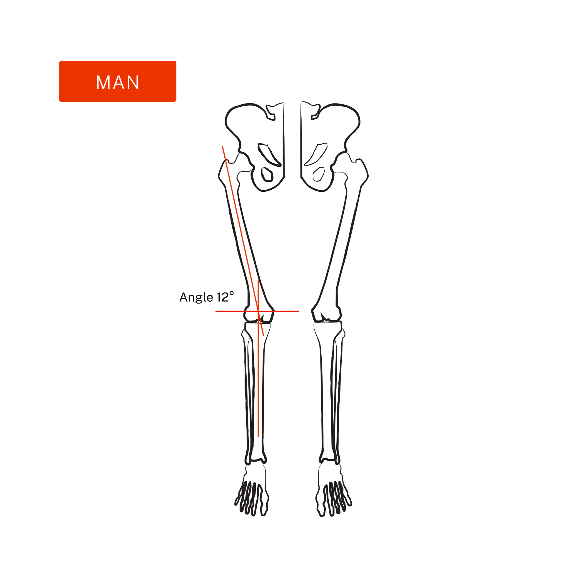 Q-angle illustration