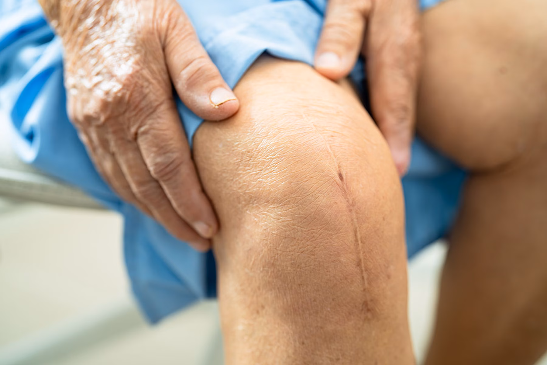 leg-injury-02