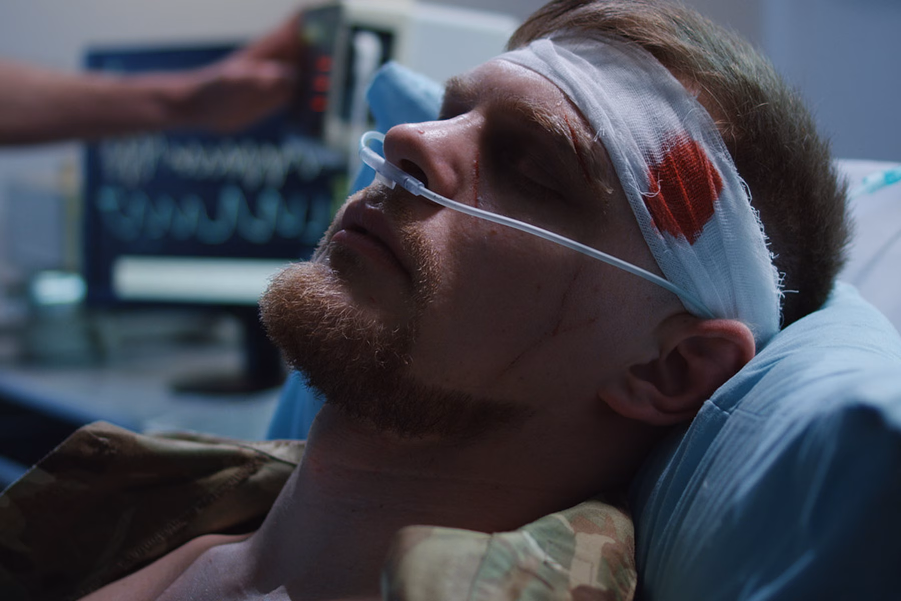 A patient with head injury