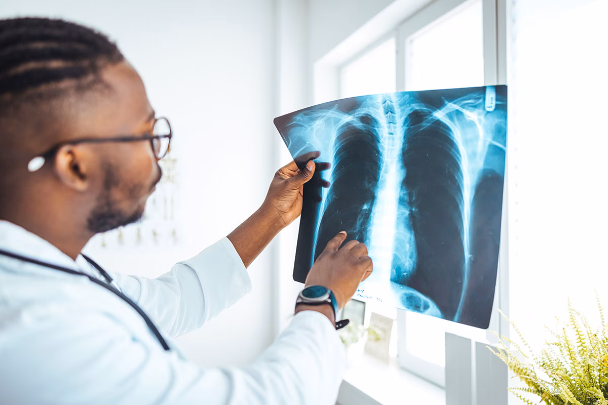 Chest x-ray