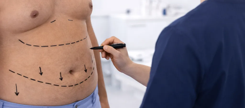 Abdominoplastika pro muže v Bangkoku: Náklady, možnosti a jak si bezpečně vybrat