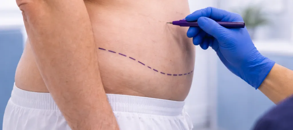 Liposukce pro muže v Bangkoku: Ceny, možnosti a jak si bezpečně vybrat