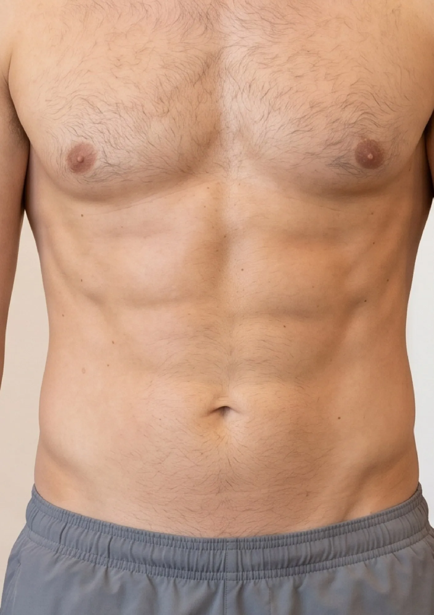 After Liposuction