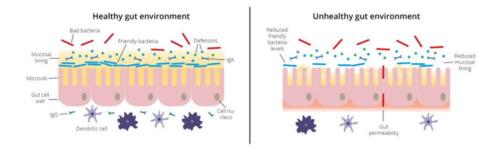 diagram of healthy and unhealthy gut wall 