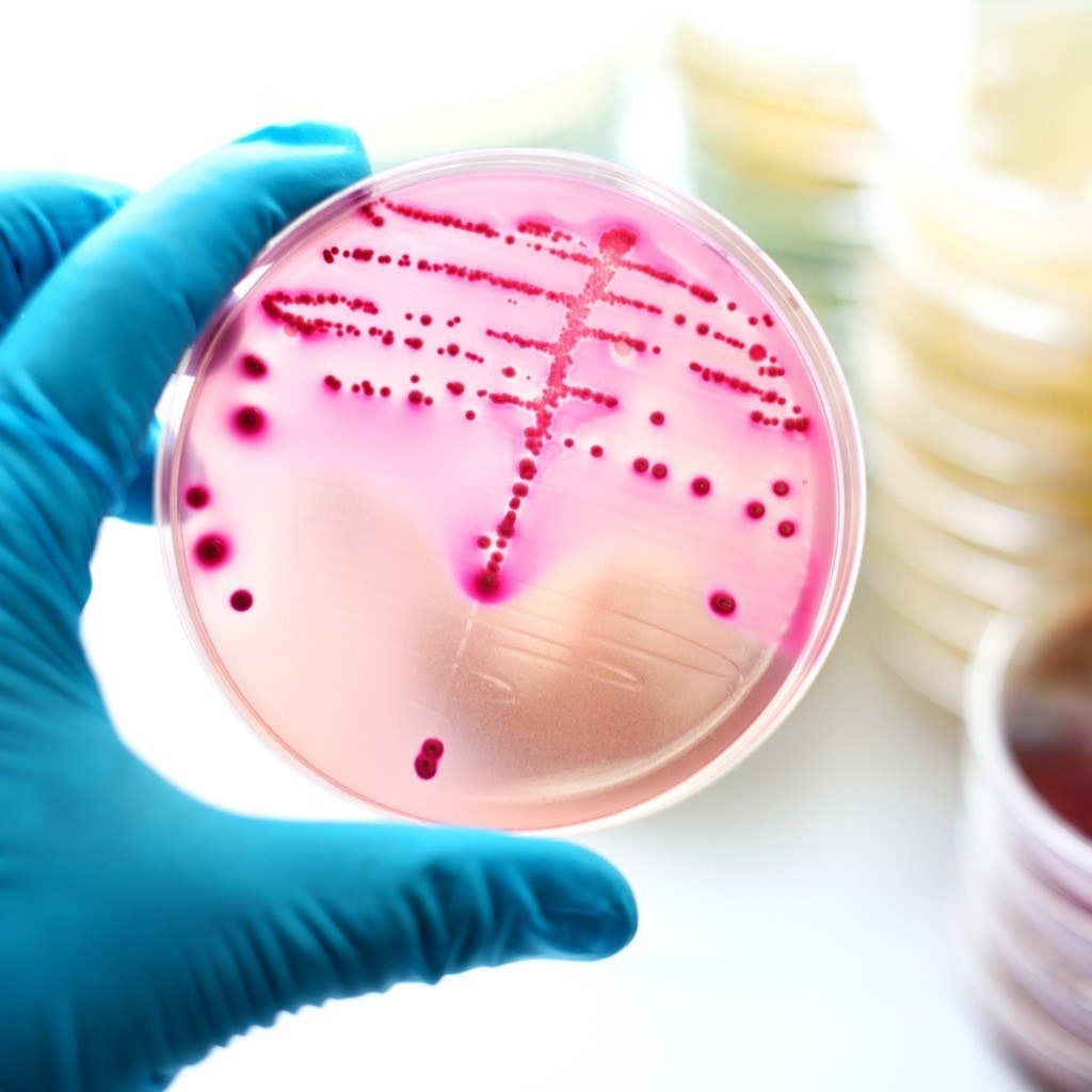 Gloved hand holding a petri dish with pink bacterial colonies on agar, with blurred dishes in the background.