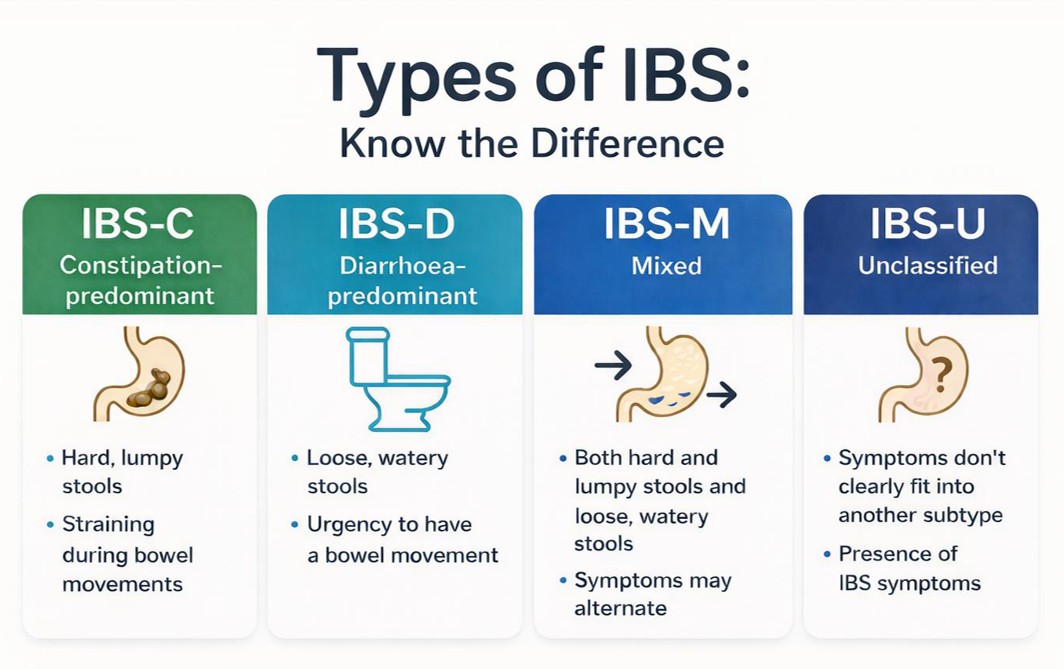 Chart showing four types of IBS: IBS-C (constipation), IBS-D (diarrhea), IBS-M (mixed), and IBS-U (unclassified), with symptoms.