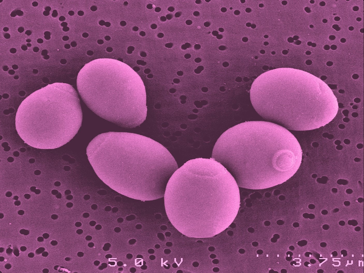 Microscopic view of six oval yeast cells in pink, scattered on a textured surface with small holes, under a scanning electron microscope.