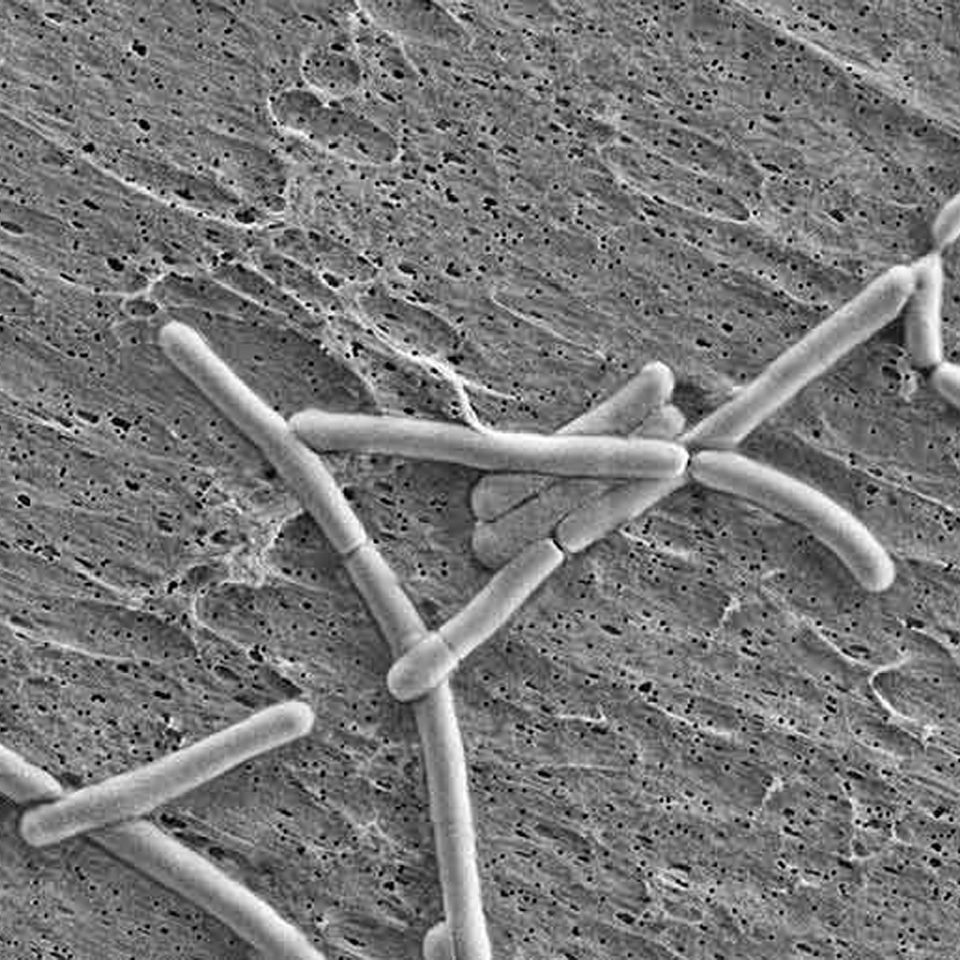 Lactobacillus rhamnosus GG®