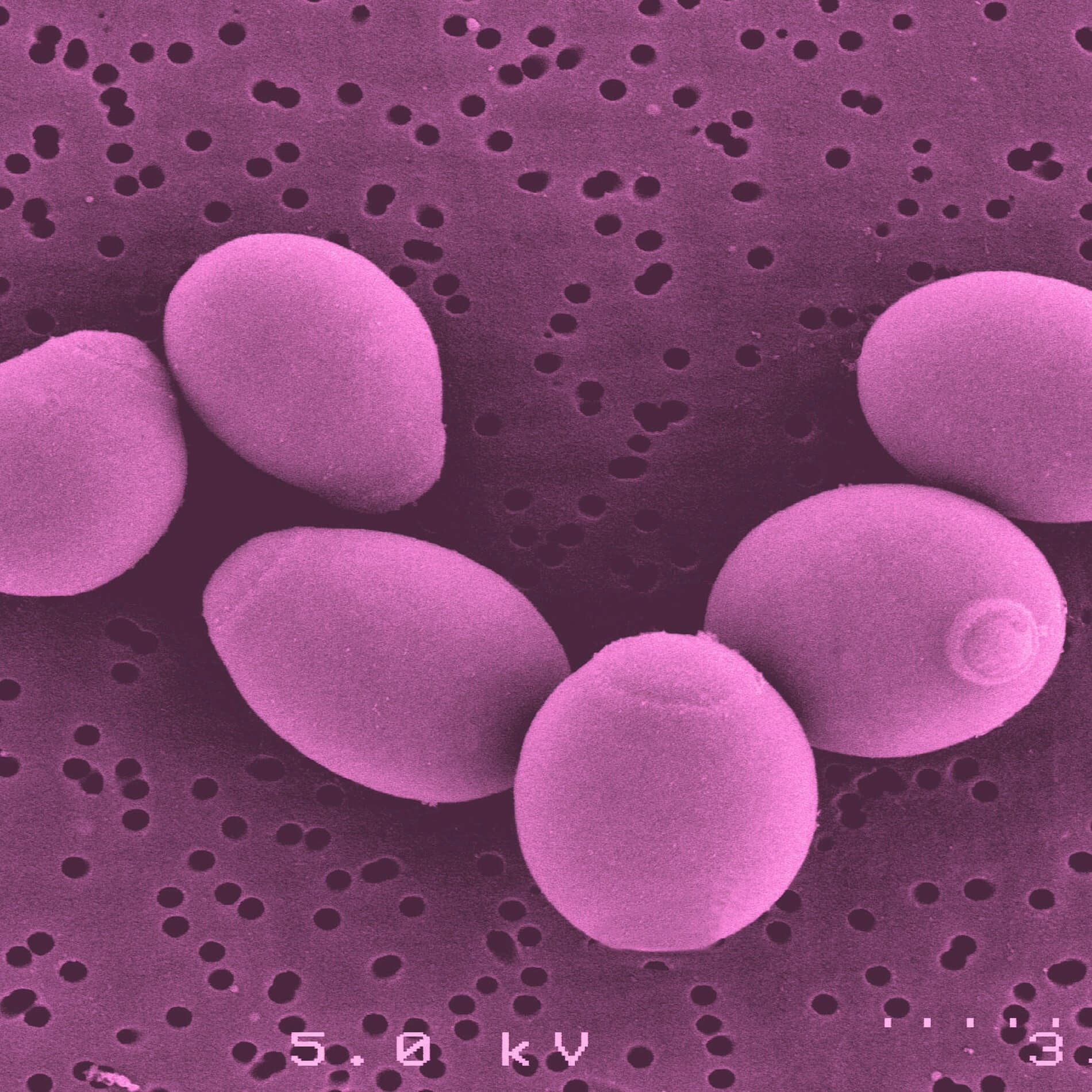 Microscopic view of purple yeast cells on a porous surface, magnified. Cells are oval-shaped and evenly distributed.