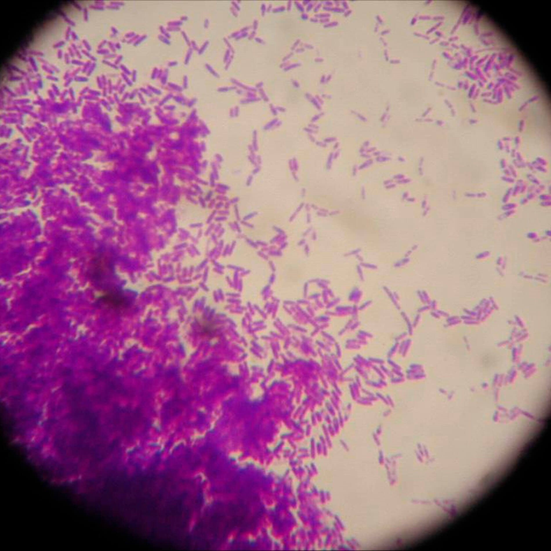 Microscopic view showing clusters of purple rod-shaped bacteria on a light background.