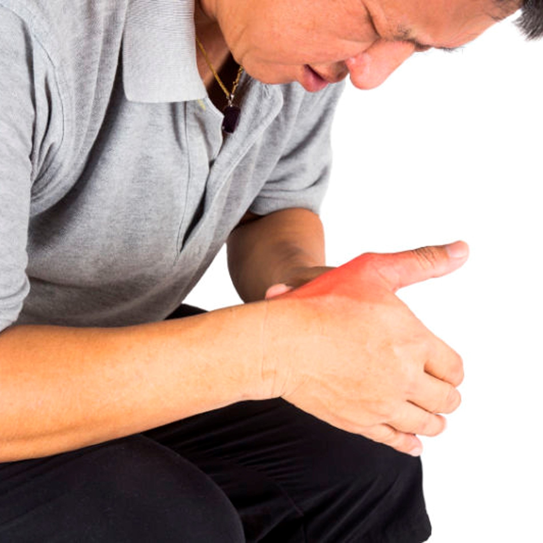 Person in a gray shirt holding their red, inflamed wrist, indicating pain or injury, against a white background.