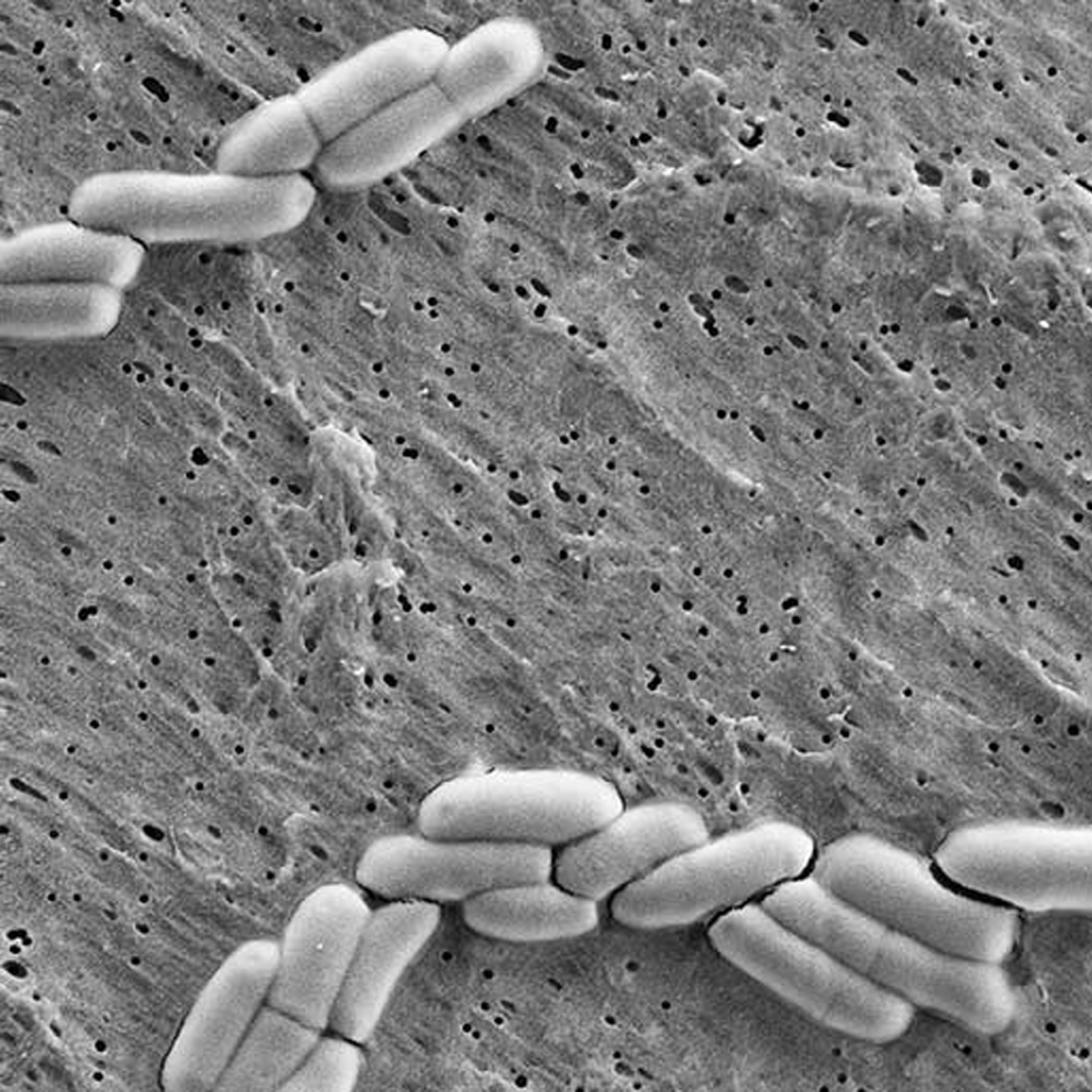 Bifidobacterium lactis BB-12®