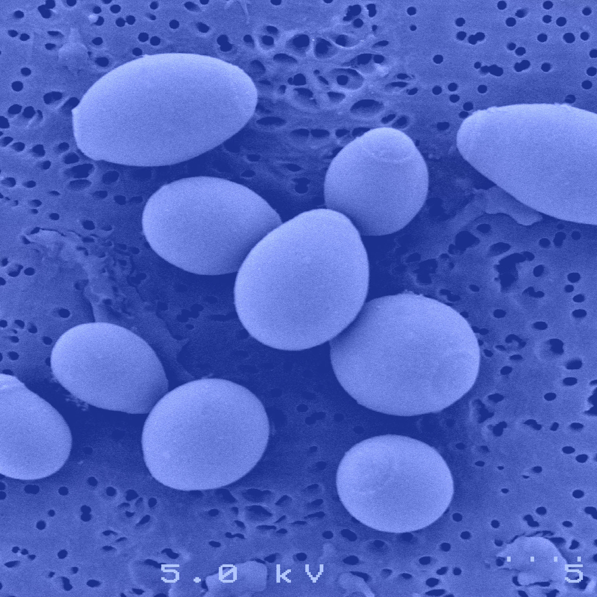 Saccharomyces cerevisiae boulardii