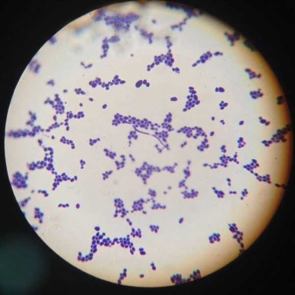 Microscopic view of purple bacteria clusters on a light background, resembling a gram stain, seen through a circular lens.