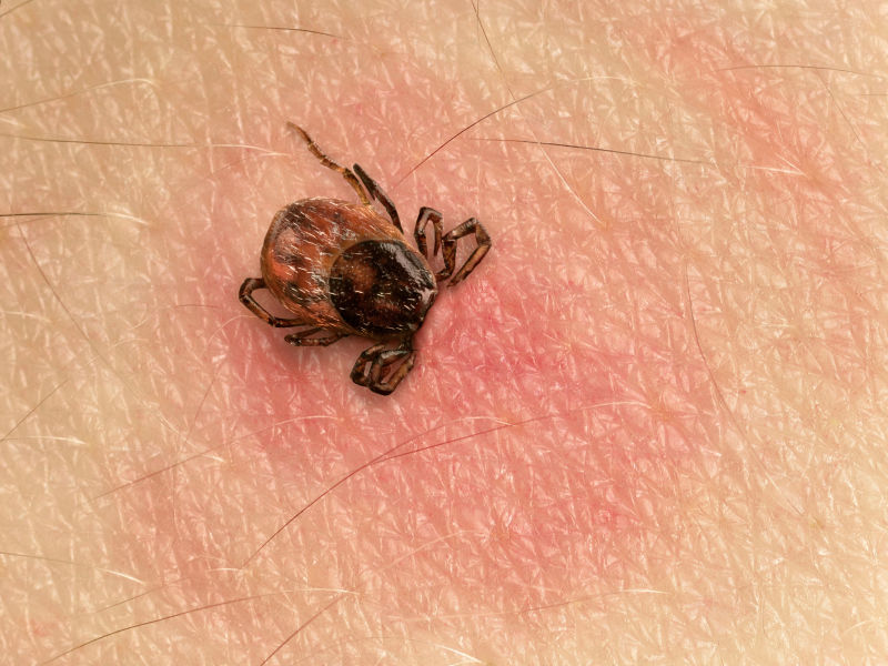 tick entering the skin 
