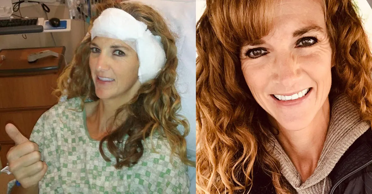 Sandi gets cochlear implant surgery