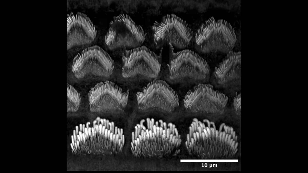 New Role for Key Hearing Proteins May Explain Permanent Hearing Loss