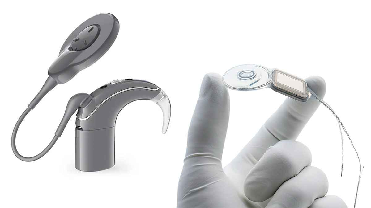 Cochlear Implants for Hearing Loss: Benefits and Risks