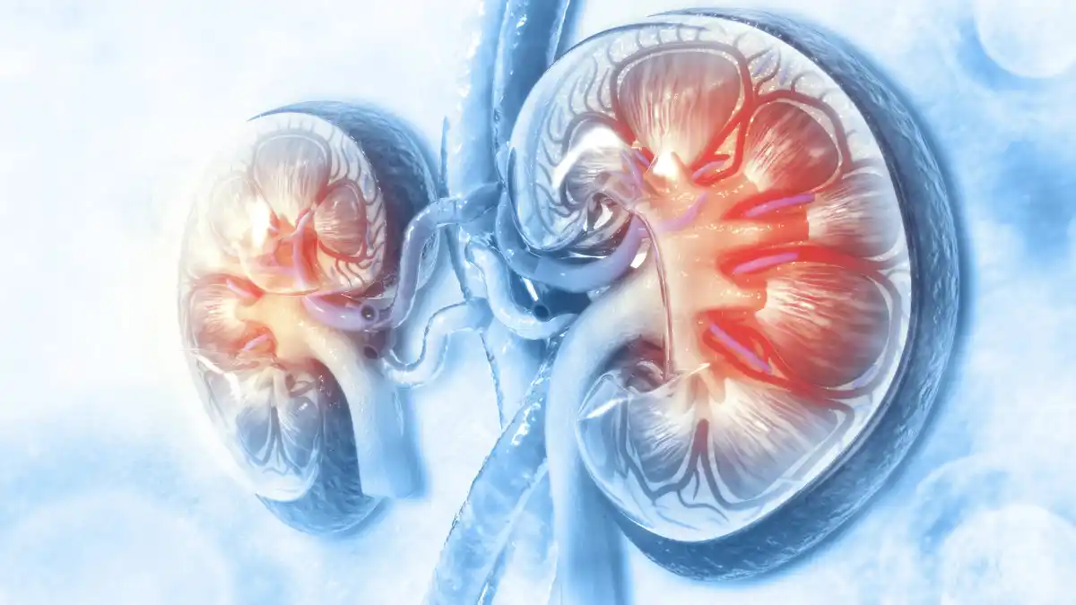 Your kidneys filter wastes and excess fluids from your blood, which are then removed in your urine. Chronic kidney disease, also called chronic kidney failure, involves a gradual loss of kidney function, causing excess levels of fluids, electrolytes, and wastes to build up in your body.