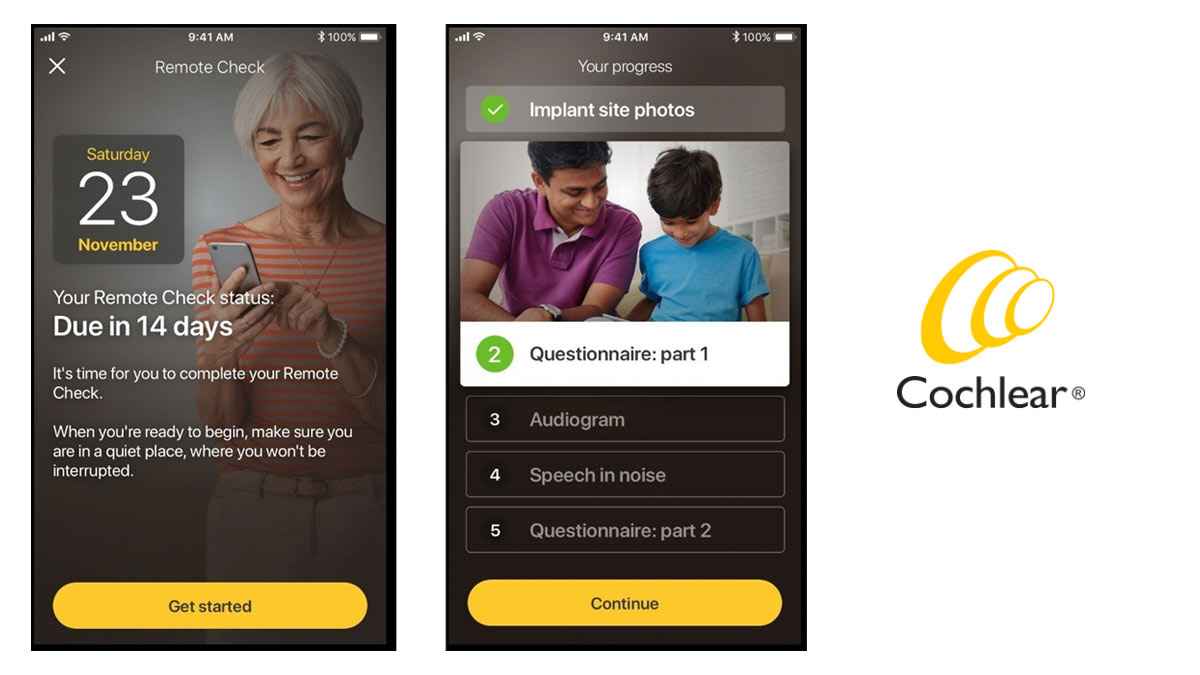 FDA Expedites Approval of Cochlear’s Remote Check Solution for Cochlear Implants