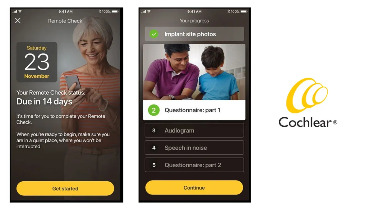 Cochlear App