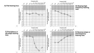 What’s a Hearing Number and Why You Should Know Yours