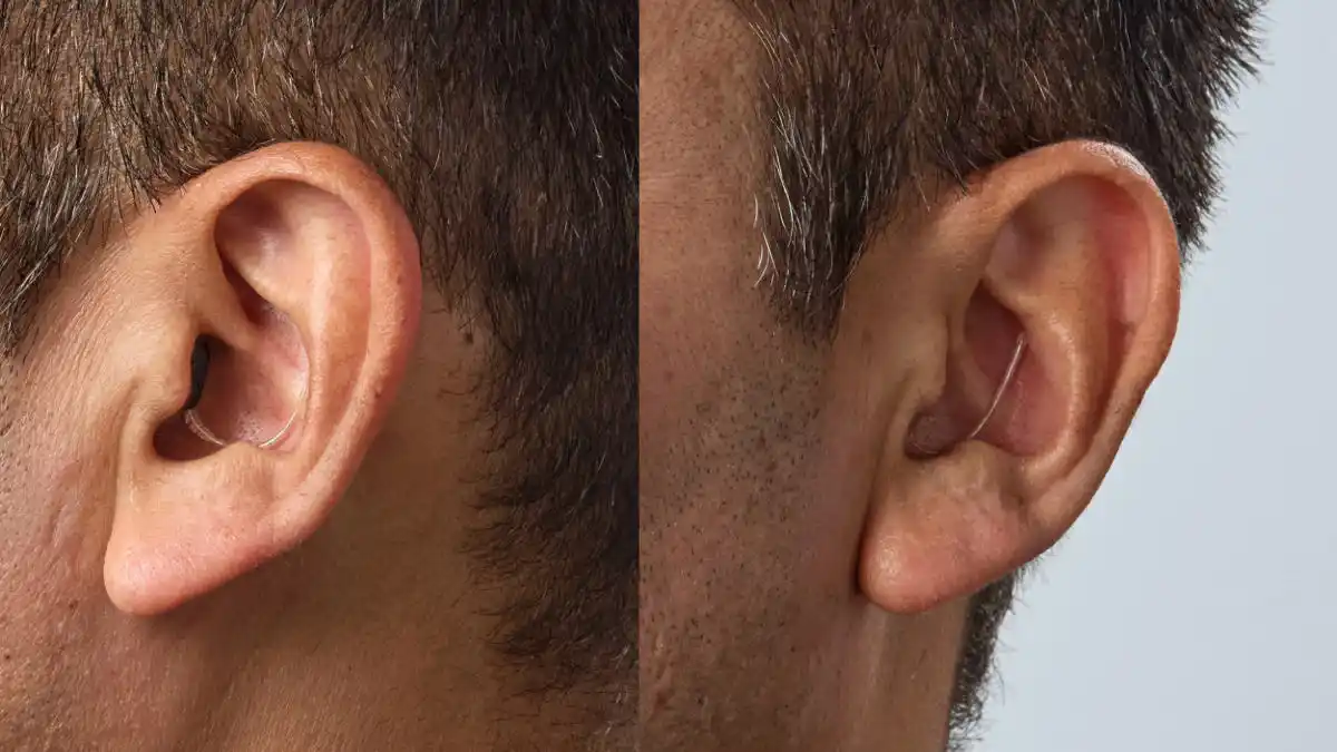 How Oticon Zeal looks in the ear.