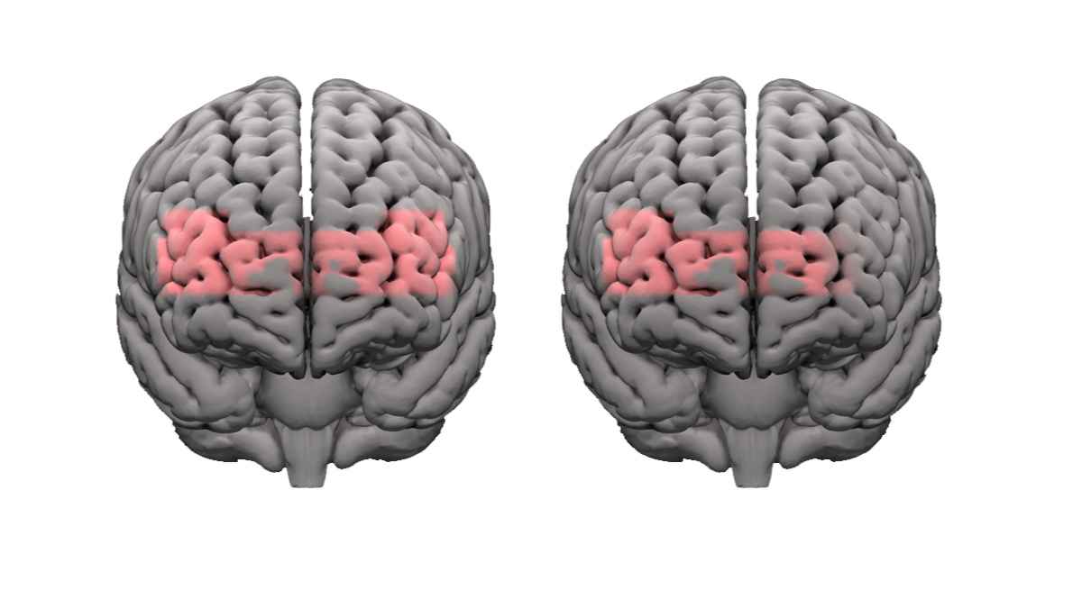 Phonak Infinio Sphere Helps Ease Cognitive Effort When Listening in Noise