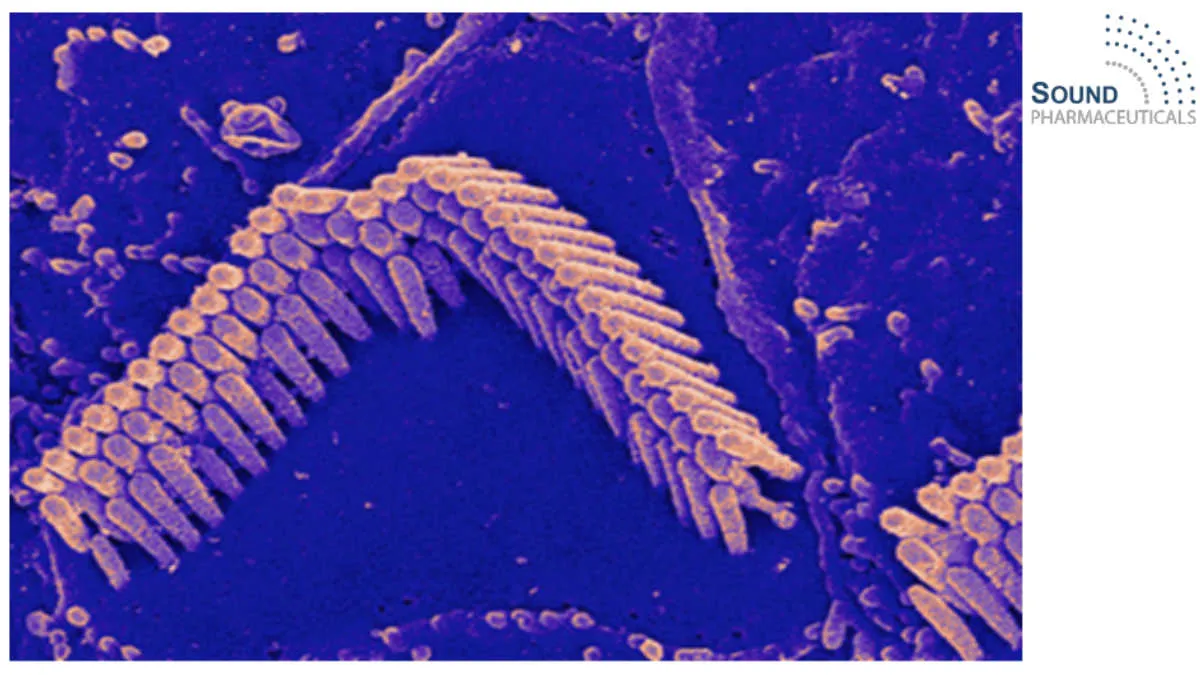 Sound Pharma Announces Positive Phase 3 Results for SPI-1005 Treatment of Meniere's Disease