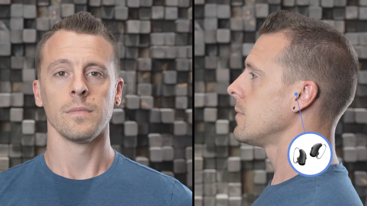 Appearance of Widex Allure from front and side on me.