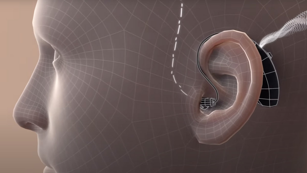 ReSound ONE: M&RIE for the most natural sound quality