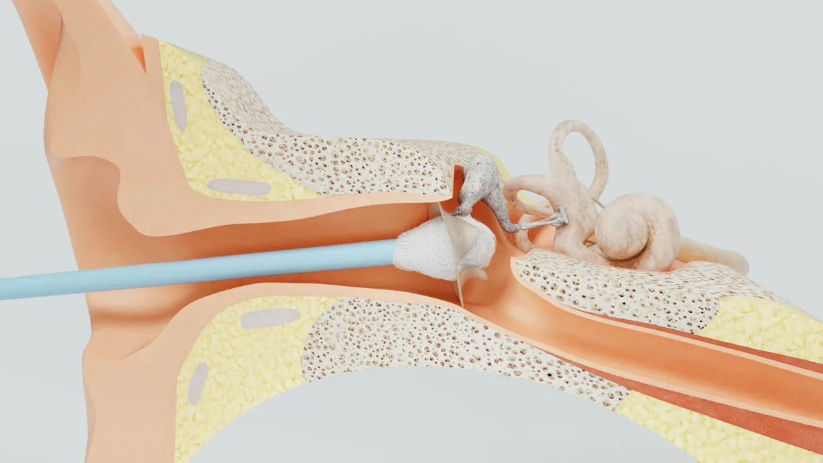 Hearing Loss Causes
