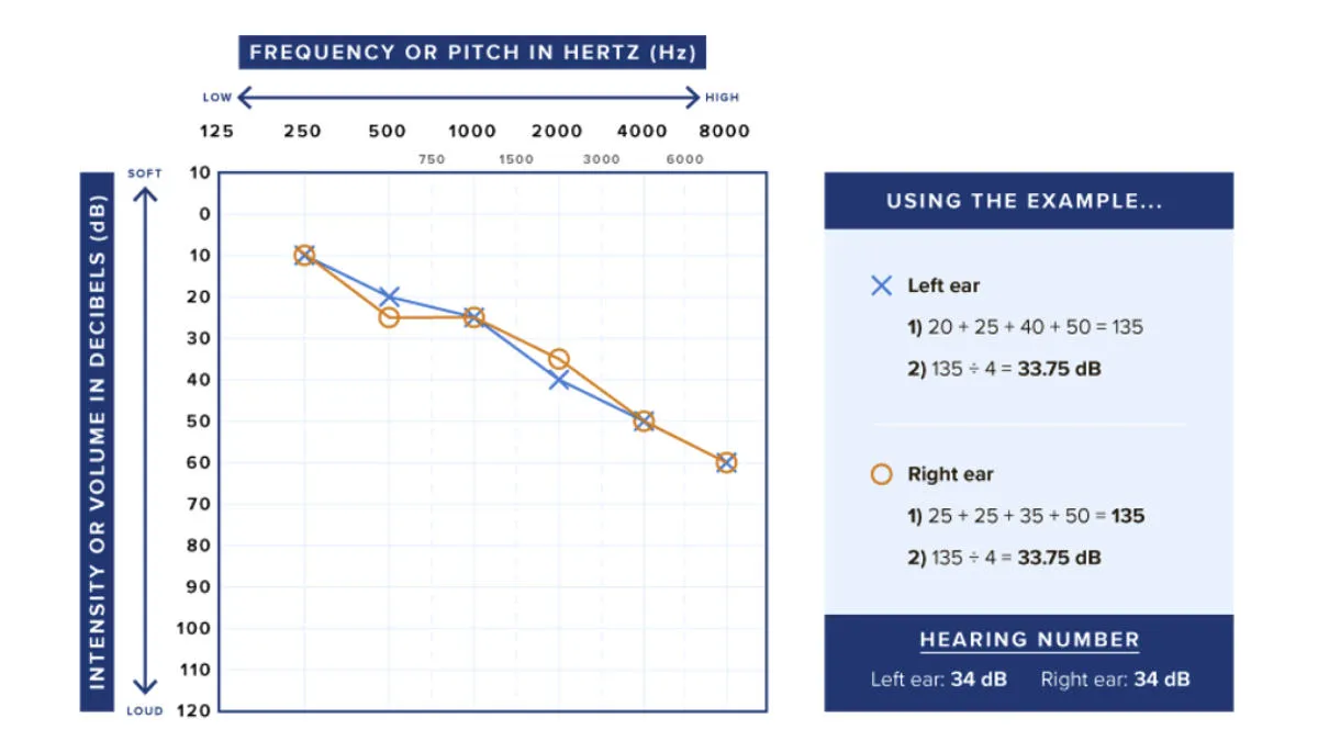 An audiogram is the most widely used measurement of hearing ability. The Hearing Number is calculated for your right and left ears, and represents the lowest volume (sound intensity or hearing level) you can hear four different pitches (frequencies) at 500, 1000, 2000, and 4000 Hz. The audiogram above shows this person has a Hearing Number of 34 dB— considered to be on the borderline between mild and moderate hearing loss. Image source: HearingNumber.org 