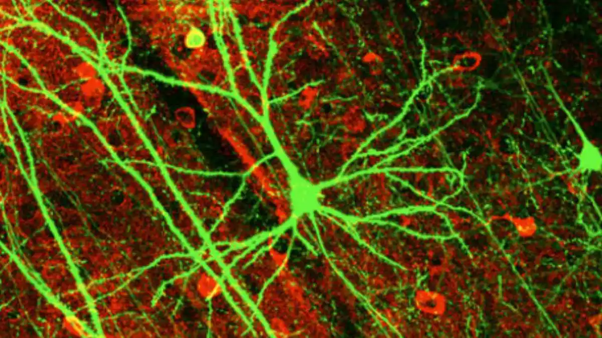 Tiefe neuronale Netzwerke oder DNNs versuchen, Neuronen (oben dargestellt) im menschlichen Gehirn durch eine Kombination aus Dateneingaben, Gewichtungen und Bias nachzuahmen. Diese Elemente arbeiten zusammen, um Objekte innerhalb der Daten zu erkennen, zu klassifizieren und zu beschreiben.