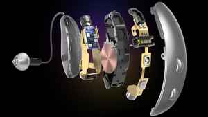 Starkey Genesis AI components.