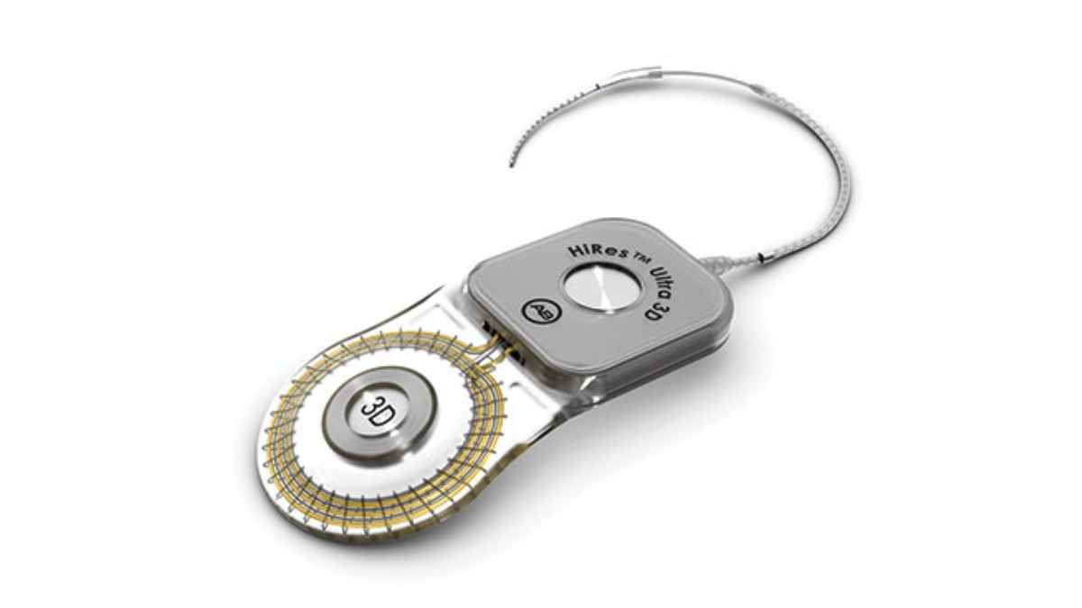 FDA Expands Advanced Bionics Cochlear Implant Candidacy to SSD and AHL