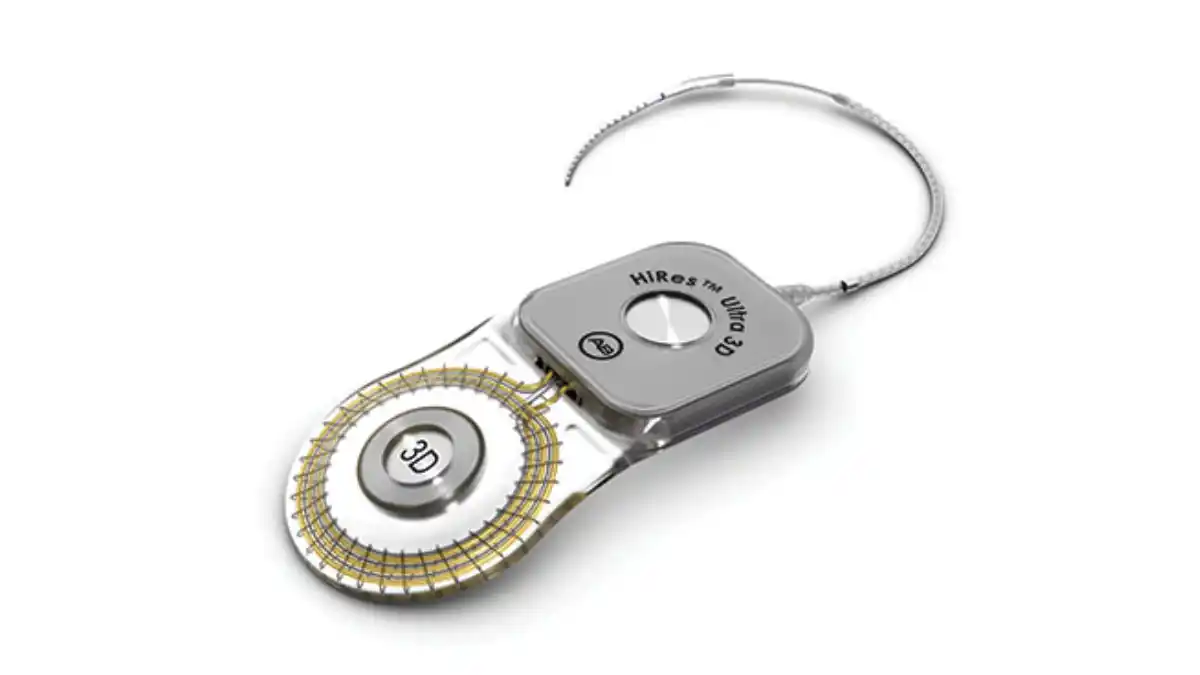 The Advanced Bionics HiRes Ultra 3D cochlear implant.