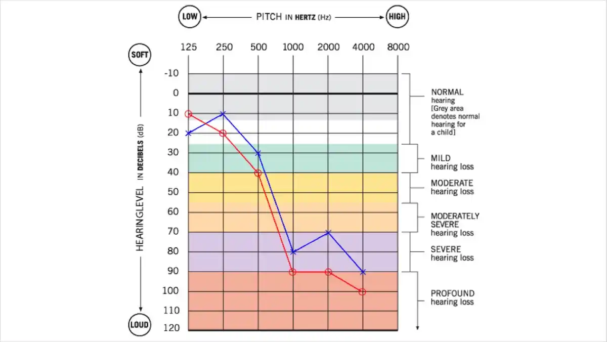 Audiogram